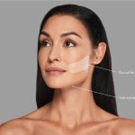 جراحی بوکال فت در سعادت آباد غرب تهران