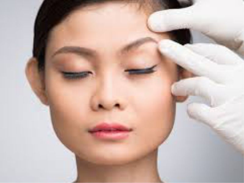 جراحی لیفت ابرو و پیشانی در تهران غرب تهران سعادت آباد