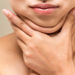 بهترین کلینیک زیبایی ساکشن غبغب در تهران