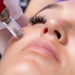 جوانسازی با میکرونیدلینگ و ترمیم با پماد زینک اکساید