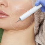 سابسیژن در سعادت آباد غرب تهران